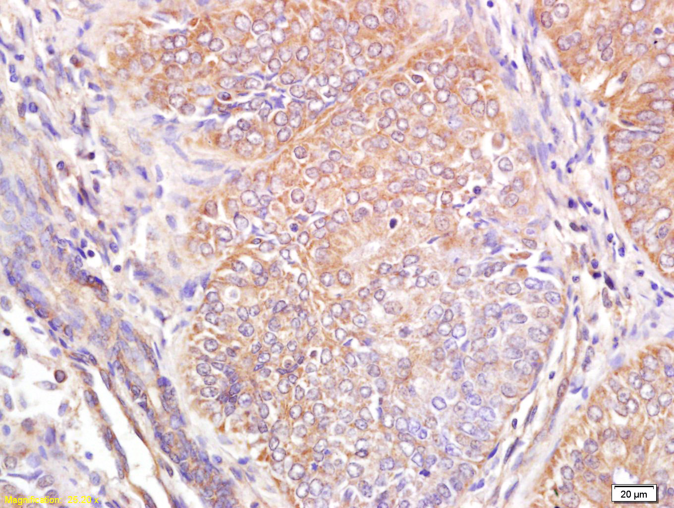 Wnt6 Rabbit pAb(bs-6135R)-50ul
