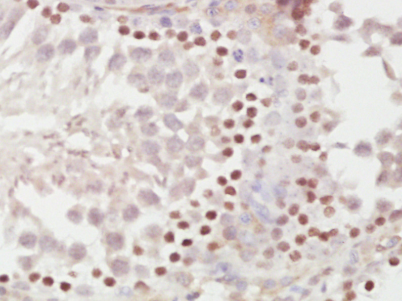 METTL11A Rabbit pAb(bs-6057R)-