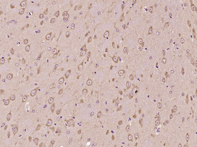 PLA2G7 Rabbit pAb(bs-1451R)-50