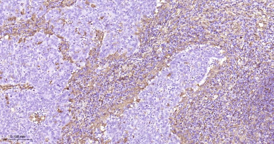 Hsp27 Recombinant Rabbit mAb(b