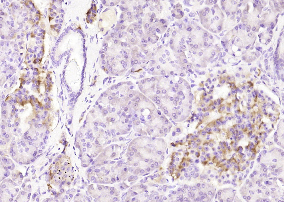 phospho-Bcl-2 (Ser70) Rabbit p