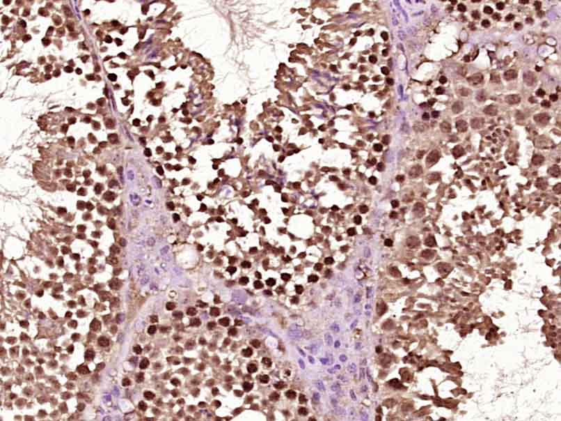 RARB Rabbit pAb(bs-0516R)-50ul