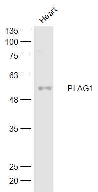 PLAG1 Rabbit pAb(bs-5969R)-50u