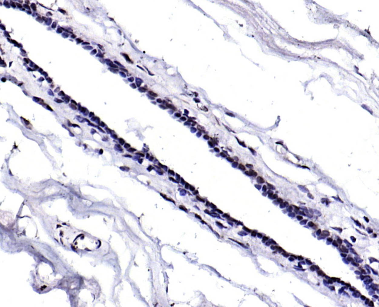 KAT4/TAF1 Rabbit pAb(bs-2812R)