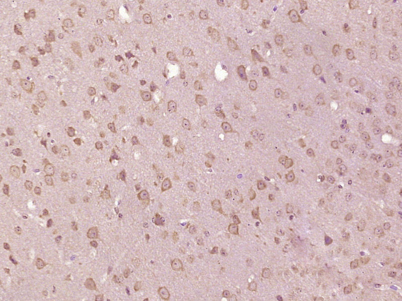 HPCAL4 Rabbit pAb(bs-17377R)-5