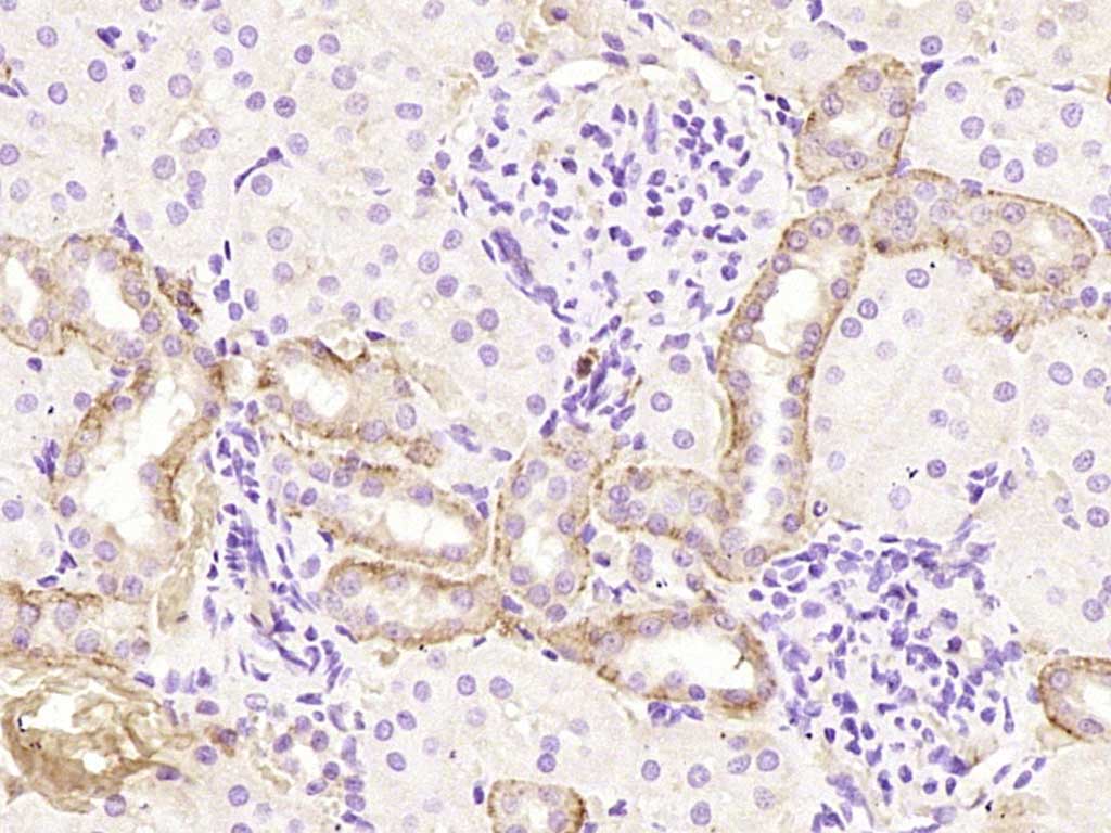 ZNT8 Rabbit pAb(bs-22560R)-50u