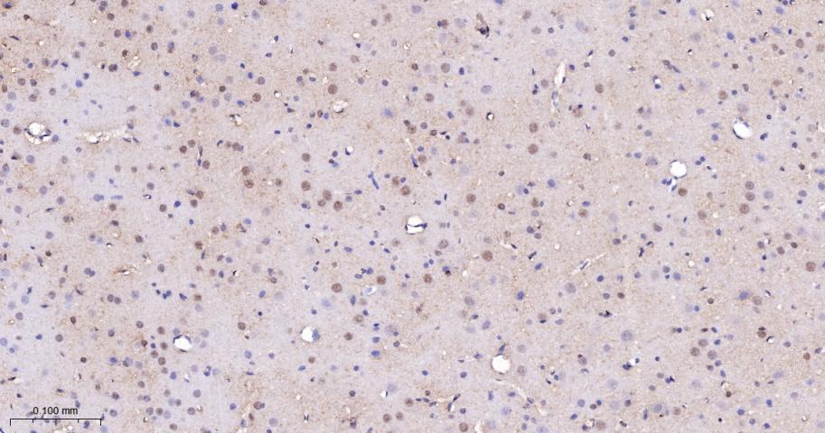 KDM4B Recombinant Rabbit mAb(b