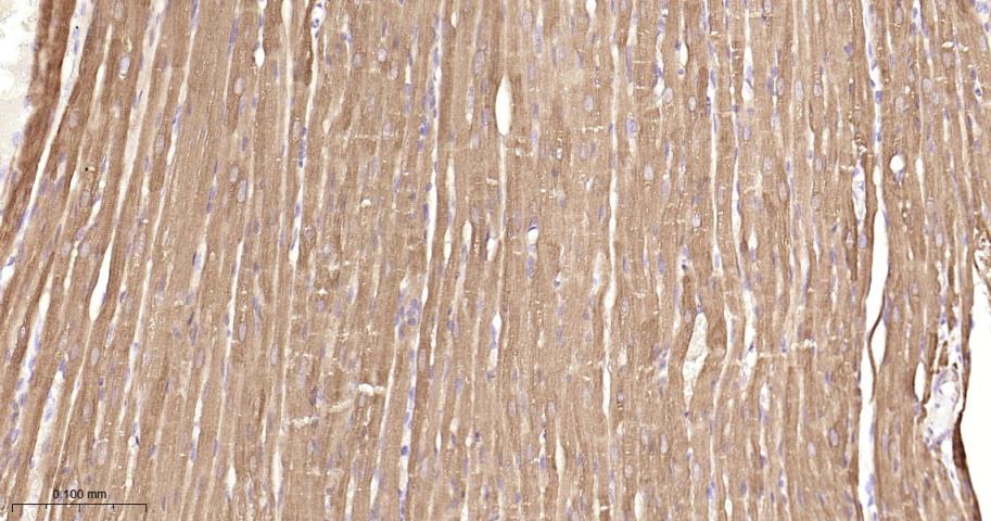 Hsp27 Recombinant Rabbit mAb(b
