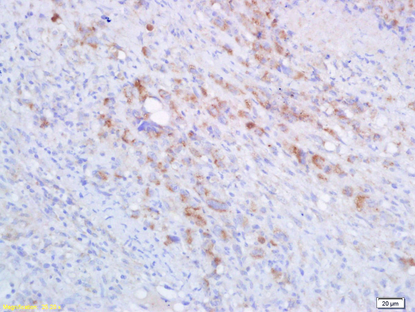 HLA-A Rabbit pAb(bs-2387R)-50u