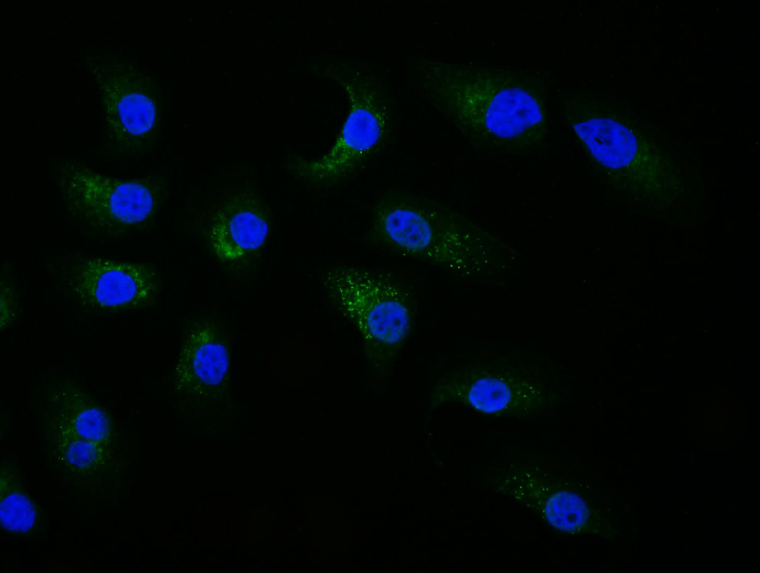 Insulin Receptor Beta Rabbit p
