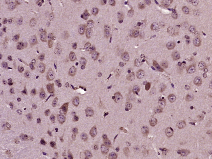 Mitofusin 2 Rabbit pAb(bs-2368