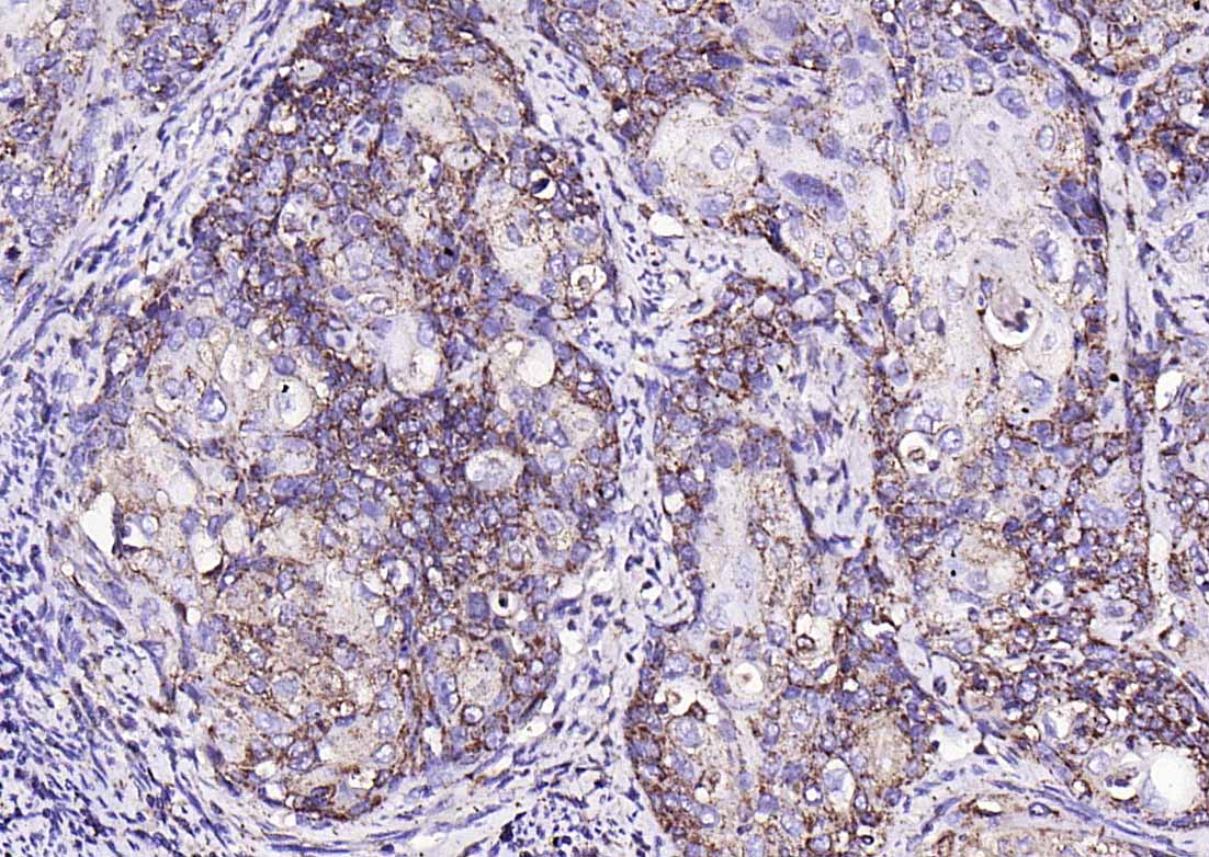 MMP-1 Rabbit pAb(bs-4597R)-50u