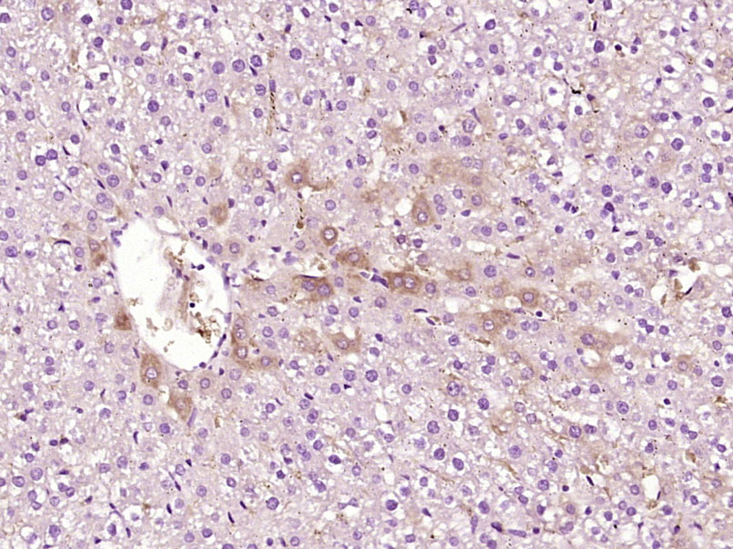 ATP7B Rabbit pAb(bs-1718R)-50u