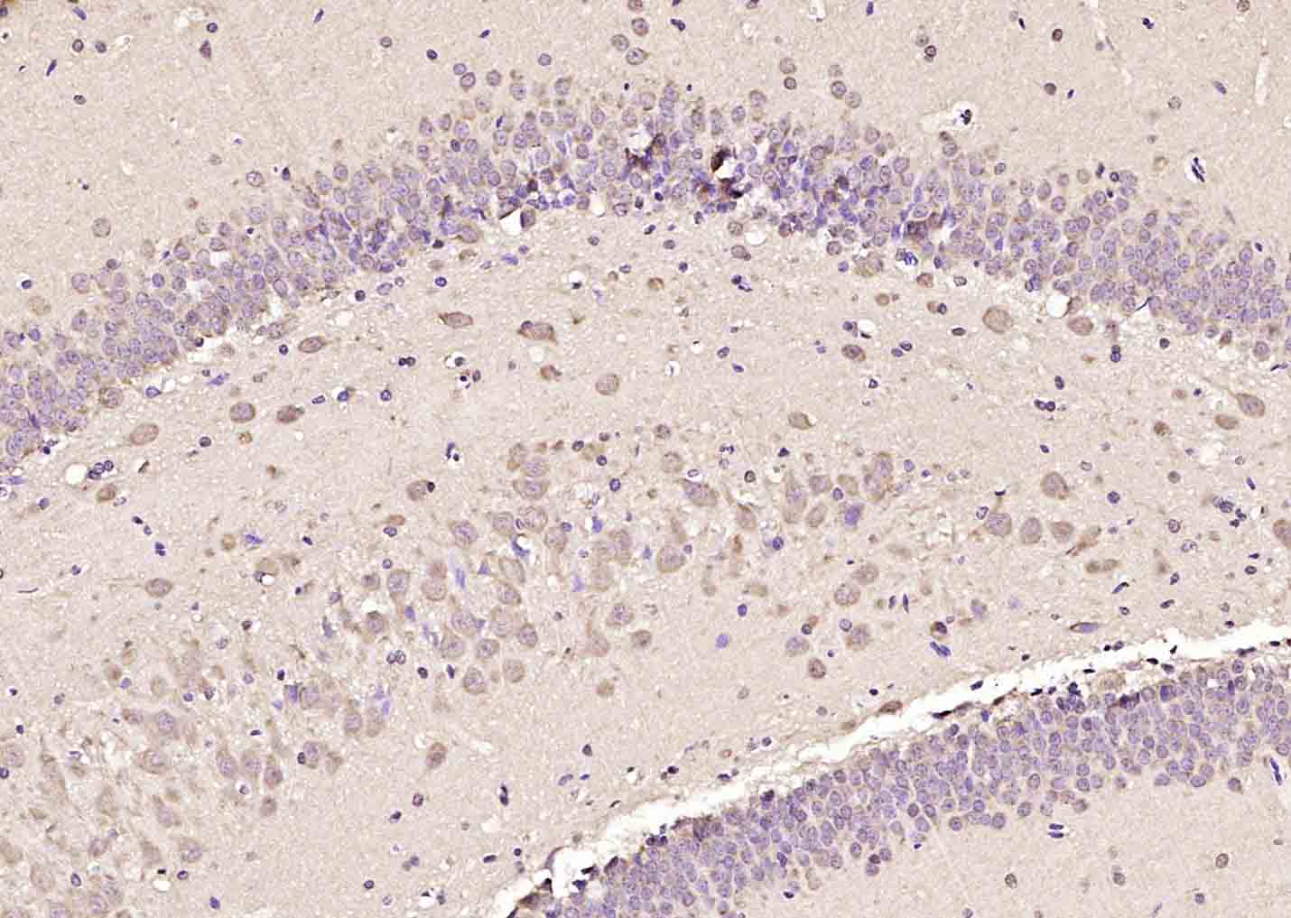 SMC2 Rabbit pAb(bs-7727R)-50ul