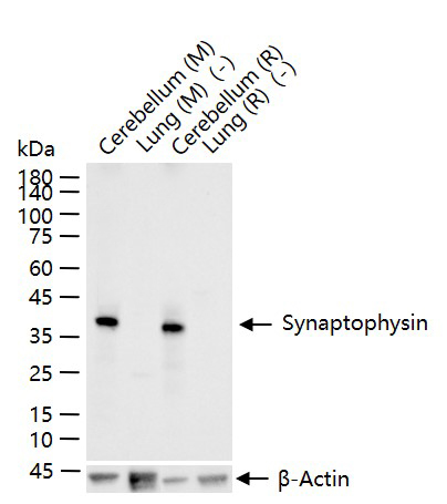 Synaptophysin Recombinant Rabb