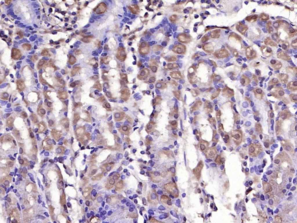 GLI1 Rabbit pAb(bs-1206R)-50ul