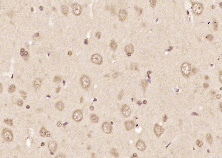 ABI2 Rabbit pAb(bs-5984R)-50ul