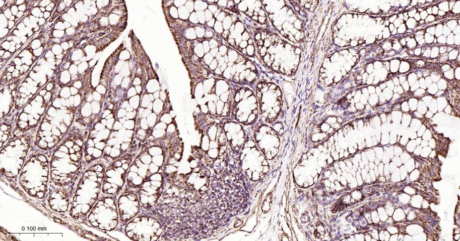 SDHB Recombinant Rabbit mAb(bs