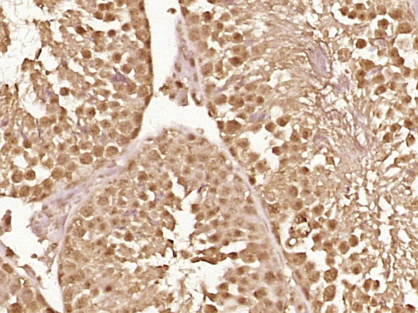 phospho-BRAF (Thr401) Rabbit p