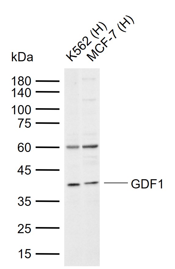 GDF1 Rabbit pAb(bs-1794R)-50ul