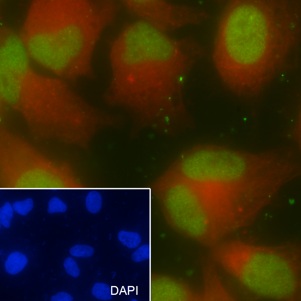 SMARCA5 Recombinant Mouse mAb(
