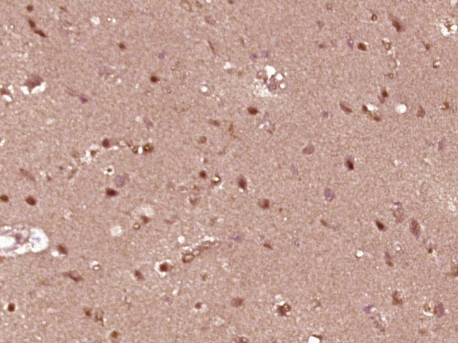 ZNF777 Rabbit pAb(bs-16460R)-5