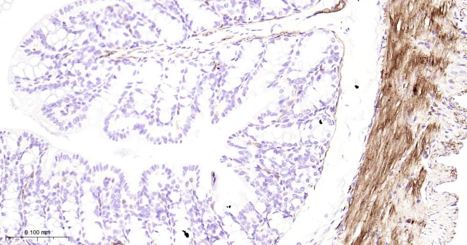 Hsp27 Recombinant Rabbit mAb(b