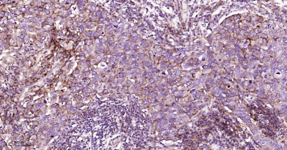 CPT1A Rabbit pAb(bs-2047R)-50u