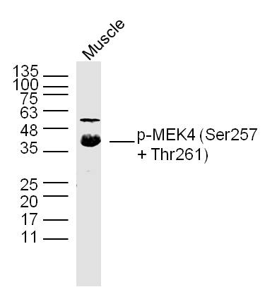 phospho-MEK4 (Ser257 + Thr261)
