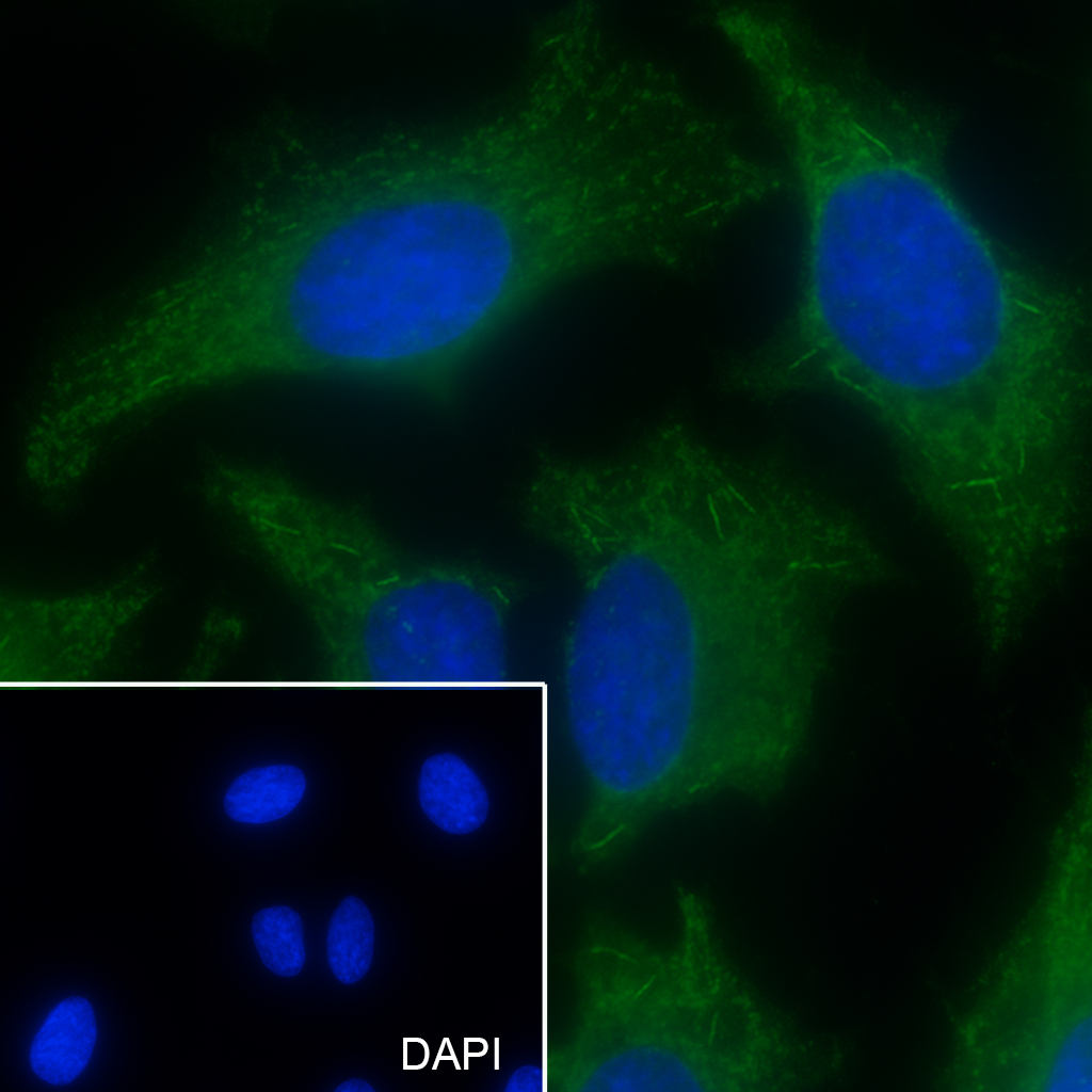 RAB3GAP1 Recombinant Mouse mAb