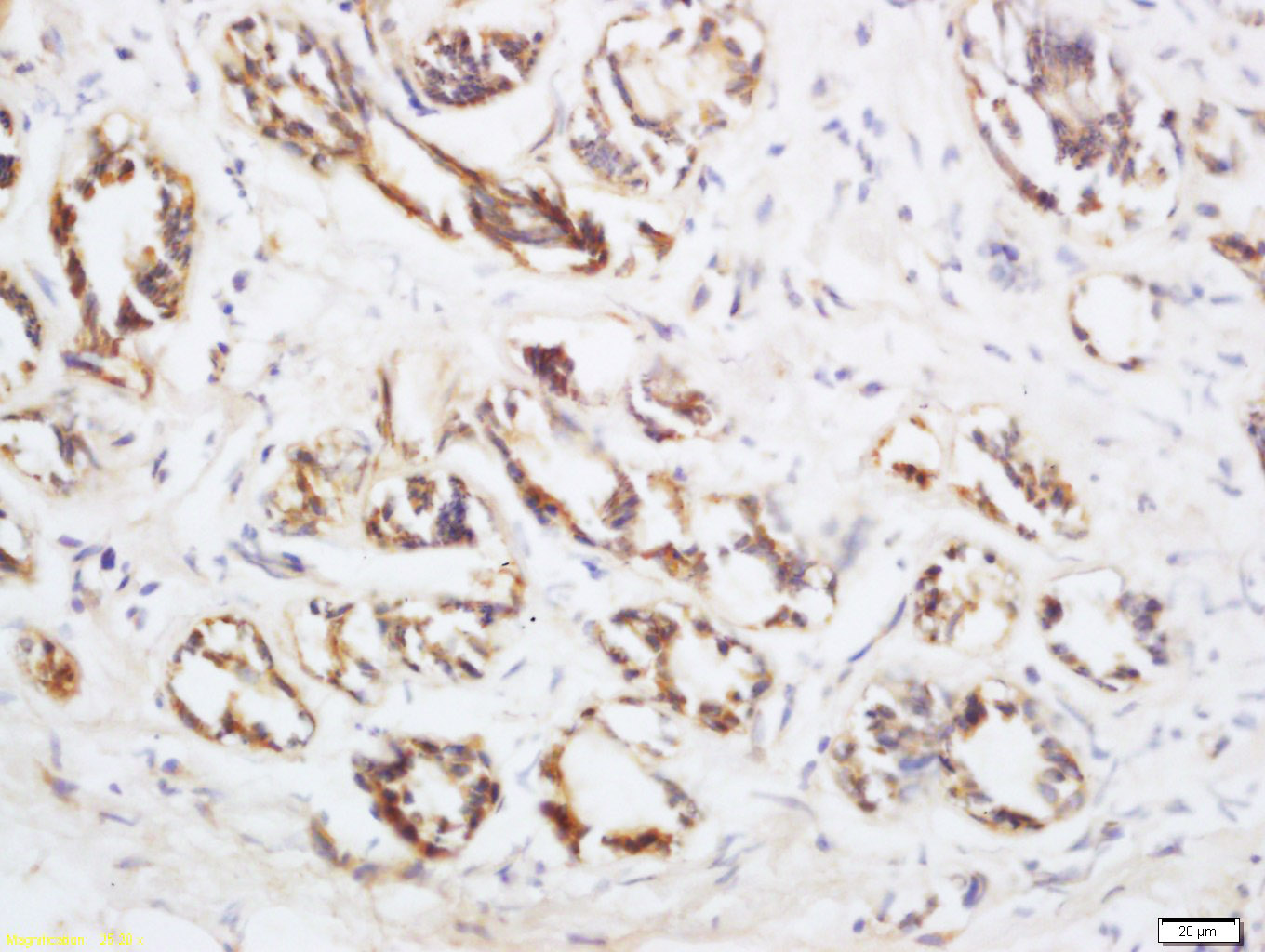 Neurturin Rabbit pAb(bs-0073R)