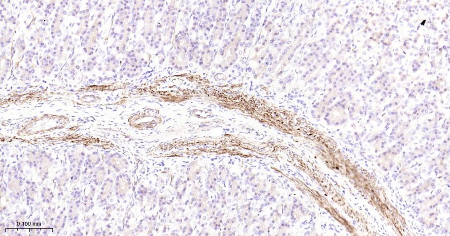 Hsp27 Recombinant Rabbit mAb(b