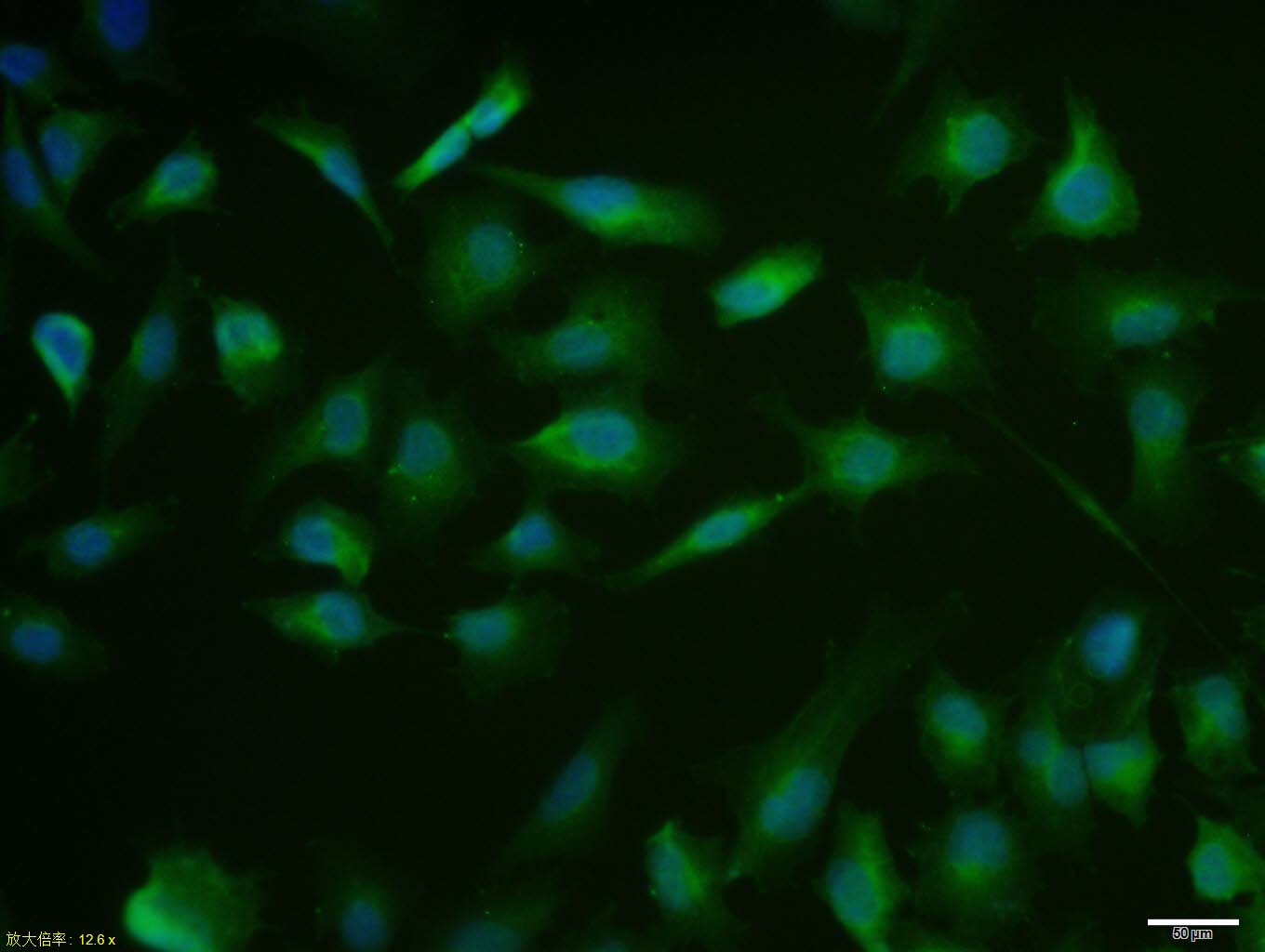 MUC1 Rabbit pAb(bs-1497R)-50ul