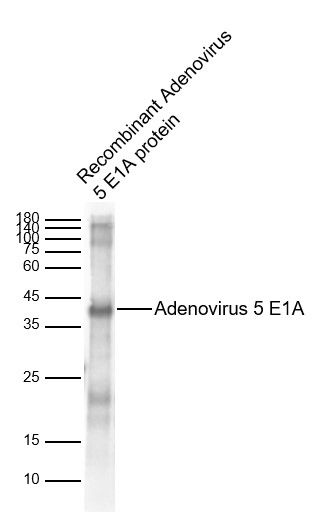 Adenovirus 5 E1A Rabbit pAb(bs