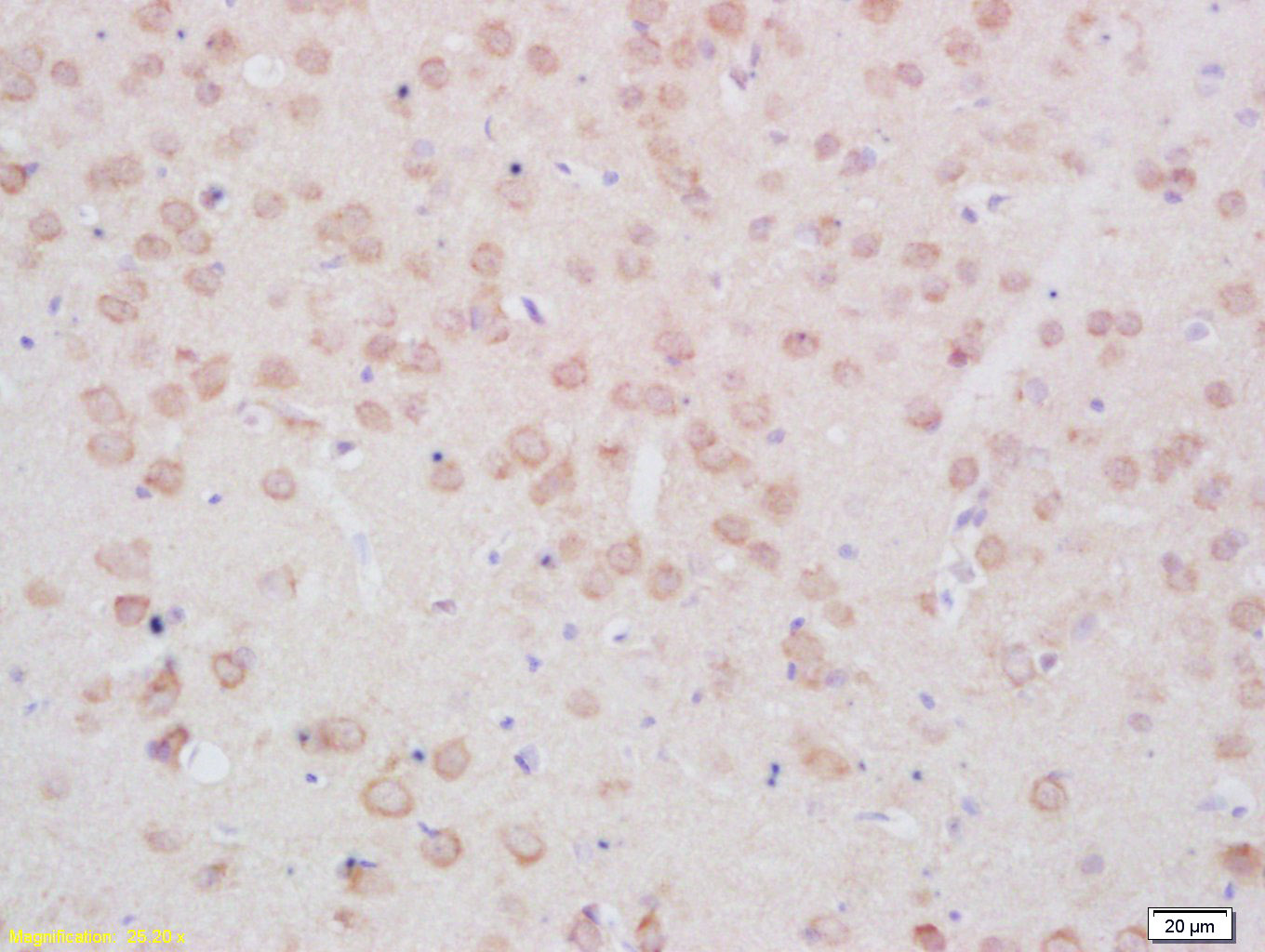phospho-TPH2 (Ser19) Rabbit pA