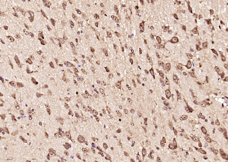 SGK2 Rabbit pAb(bs-17316R)-50u