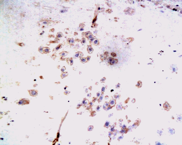 TFPI-2 Rabbit pAb(bs-1144R)-50