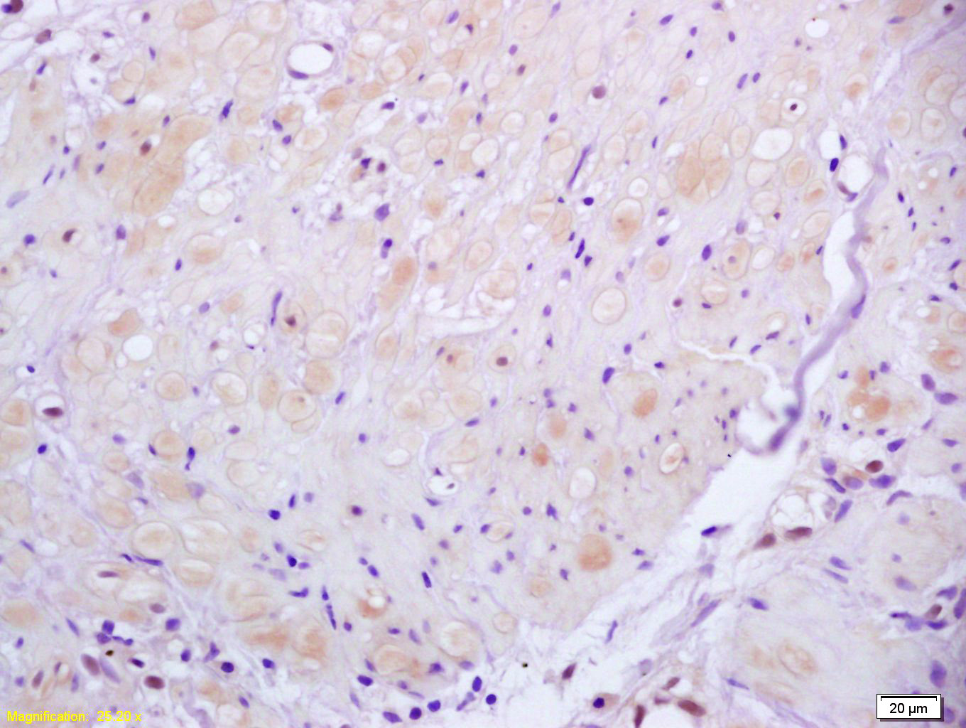 ROCK2 Rabbit pAb(bs-1205R)-50u