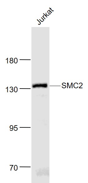 SMC2 Rabbit pAb(bs-7727R)-50ul
