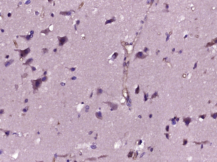 WISP2 Rabbit pAb(bs-5100R)-50u