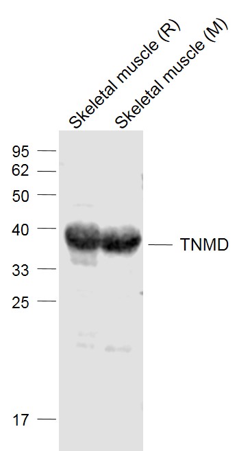TNMD Rabbit pAb(bs-7525R)-50ul