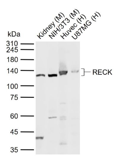 RECK Rabbit pAb(bs-2901R)-50ul