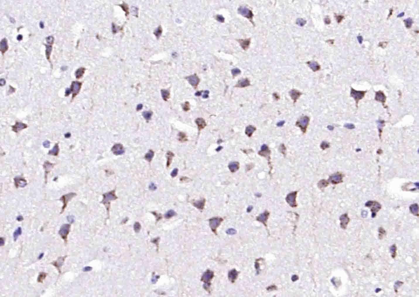 TPA Rabbit pAb(bs-1545R)-50ul/