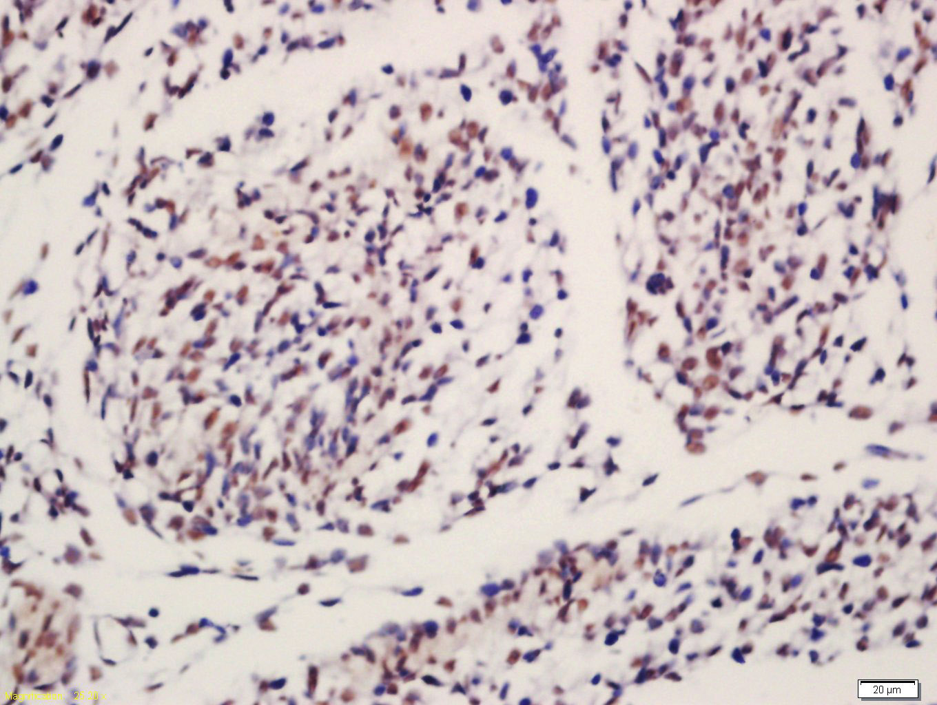 IGF2BP1 Rabbit pAb(bs-8683R)-5