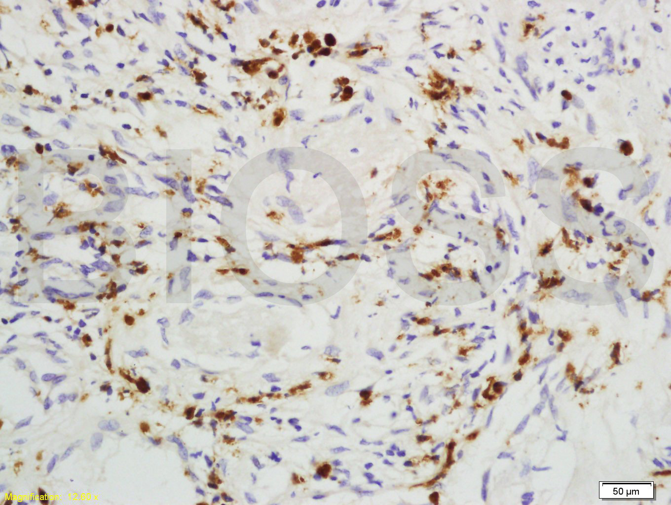 PEG10 Rabbit pAb(bs-1084R)-50u