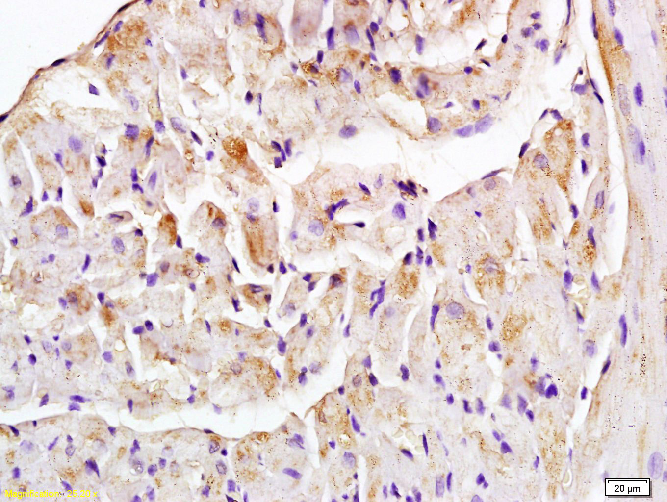 TOP1MT Rabbit pAb(bs-1211R)-50