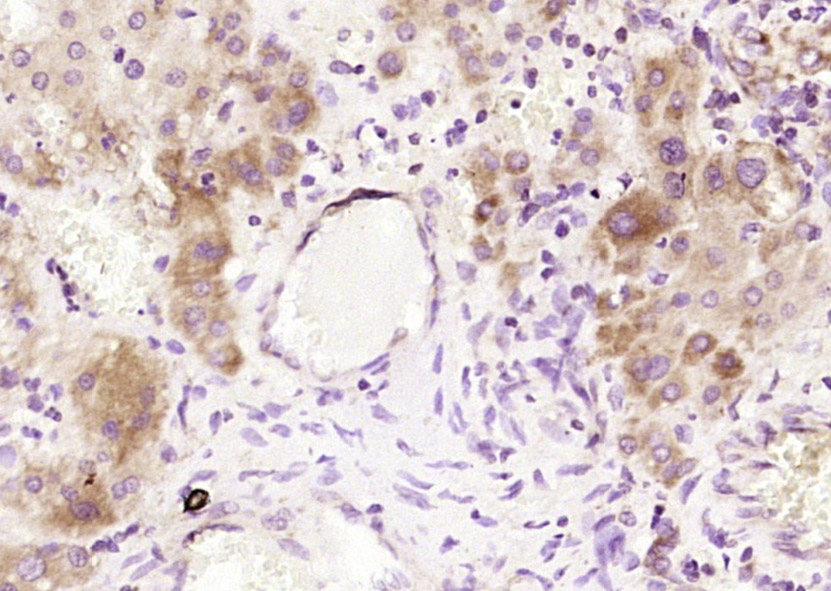 Alpha 2 antiplasmin Rabbit pAb