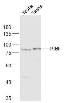 PIBF Rabbit pAb(bs-0420R)-50ul