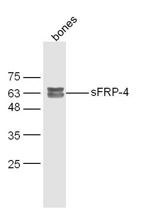 SFRP4 Rabbit pAb(bs-1331R)-50u