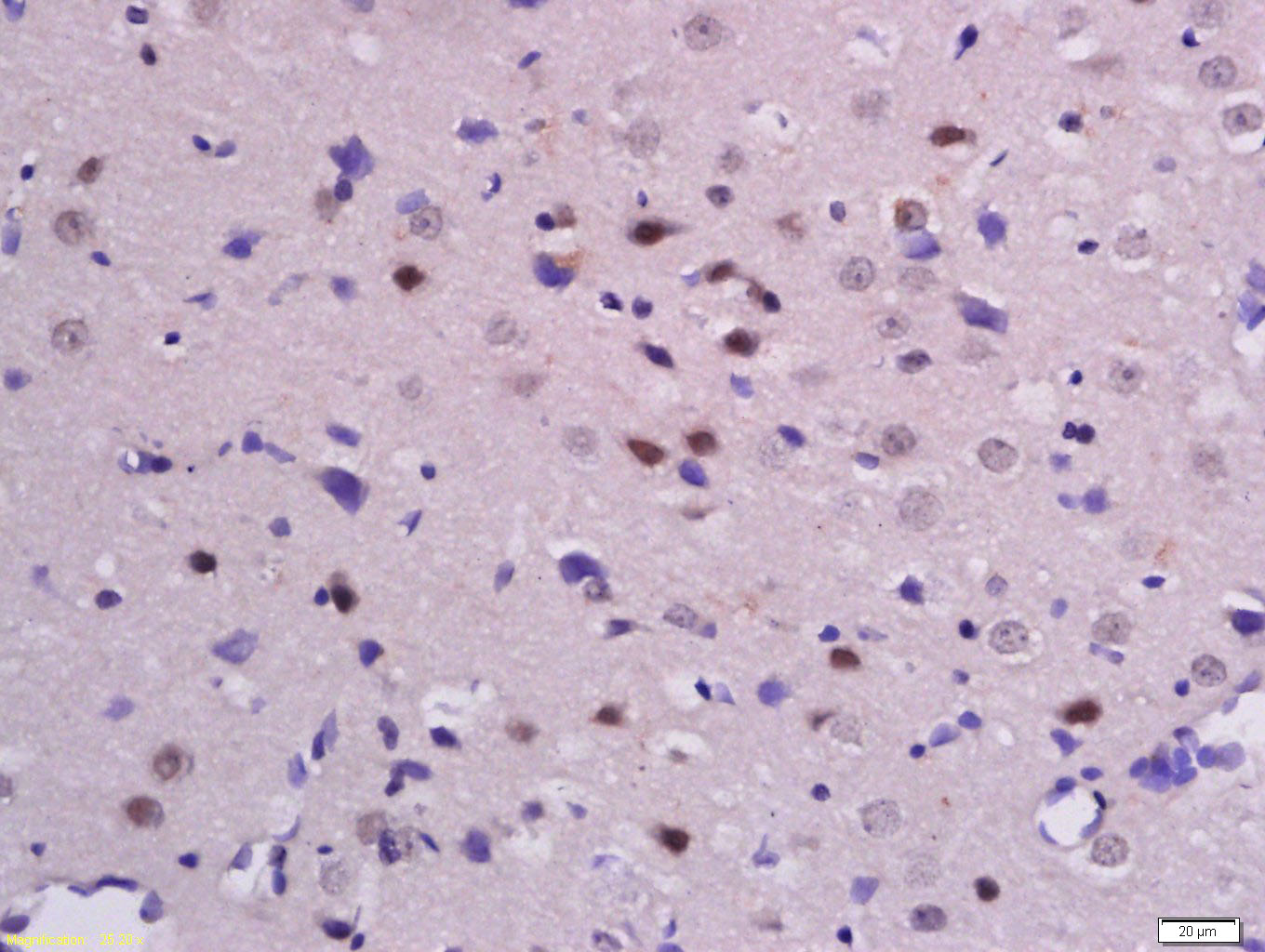 phospho-Beta catenin (Ser33 + 